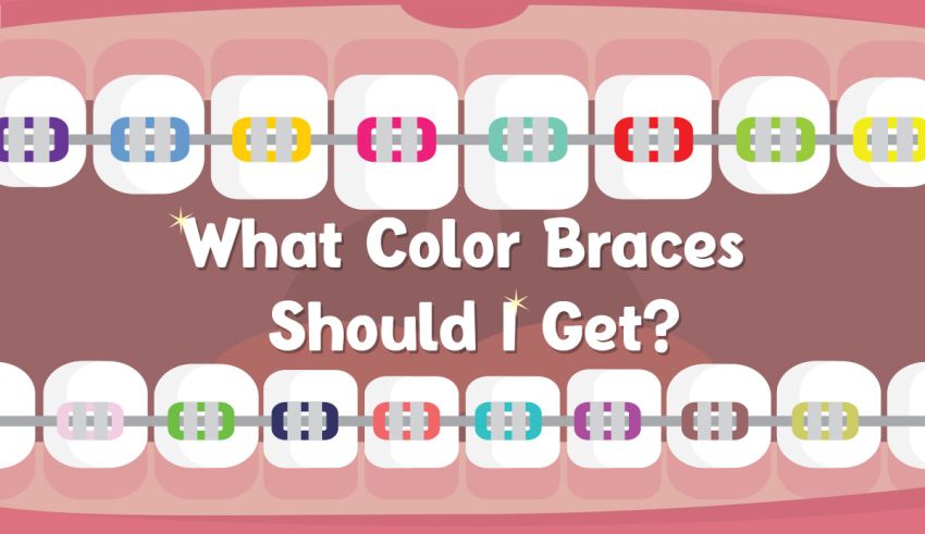 what color braces should i get